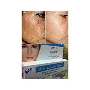 Best Cream Anti-Melasma Reduces Age Spots, Sun Spots, Pigmentation, Freckles 15 G. x 2 Tubes